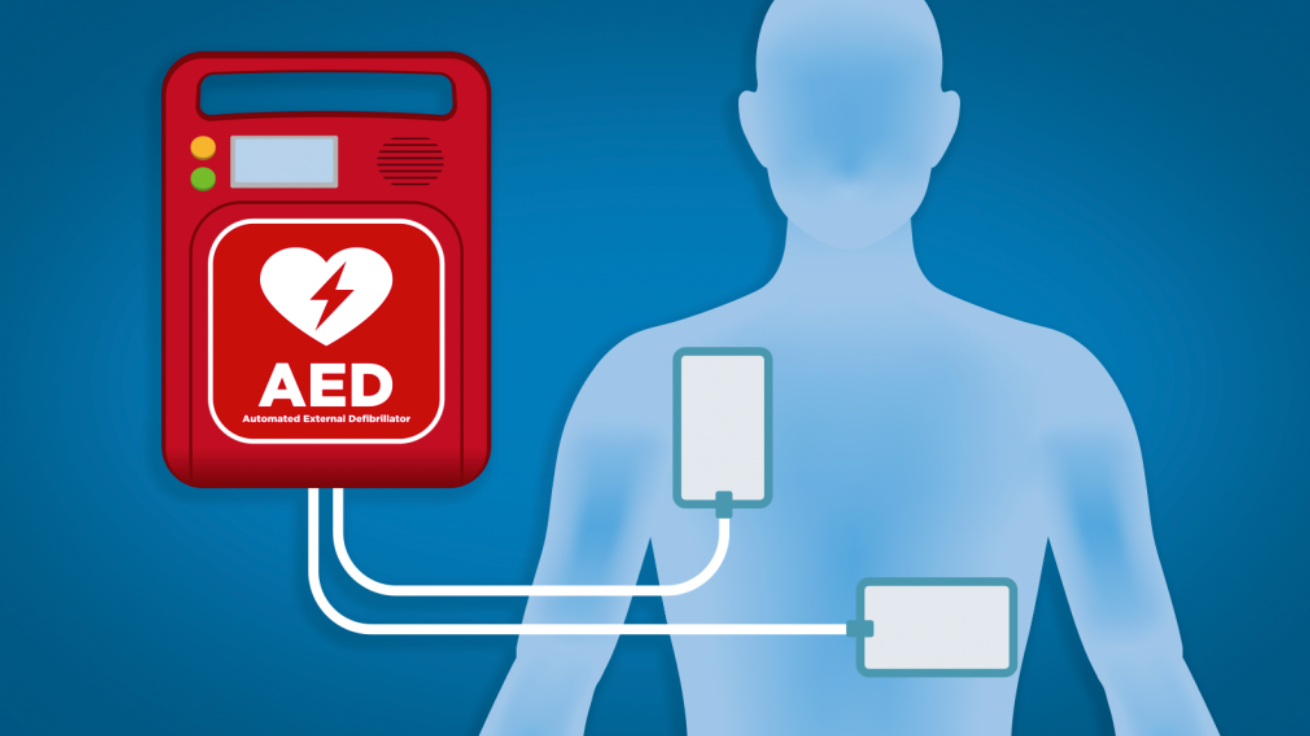 How AEDs in Public Places Can Restart Hearts
