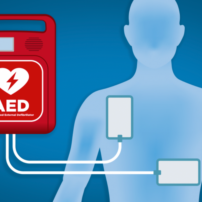How AEDs in Public Places Can Restart Hearts