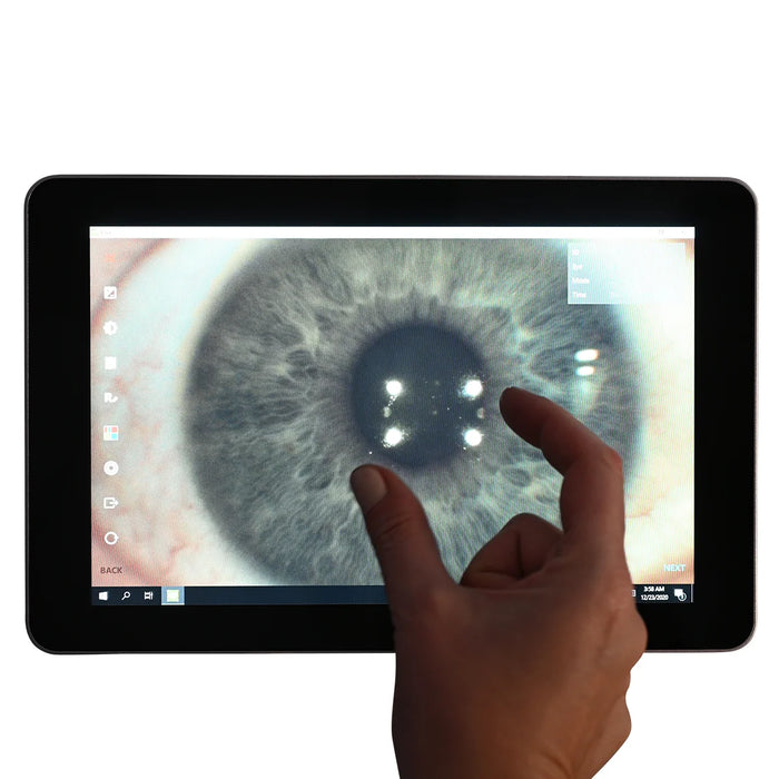 Automatic Non-Mydriatic Retinal Camera EFC-2600 – 12 MP