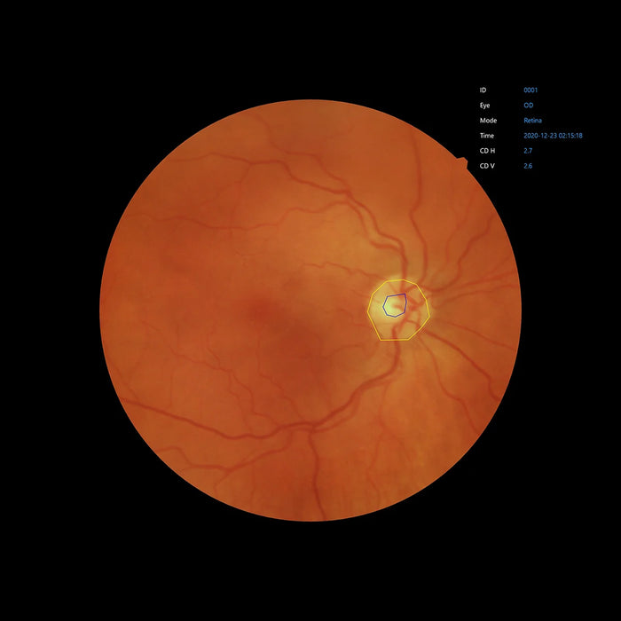 Automatic Non-Mydriatic Retinal Camera EFC-2600 – 12 MP