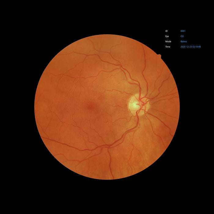 Automatic Non-Mydriatic Retinal Camera EFC-2600 – 12 MP
