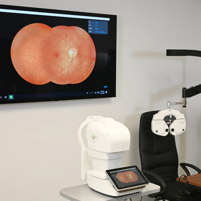Automatic Non-Mydriatic Retinal Camera EFC-2600 – 12 MP