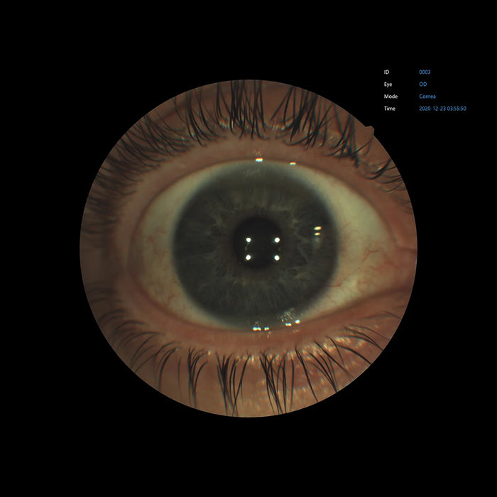 Automatic Non-Mydriatic Retinal Camera EFC-2600 – 12 MP