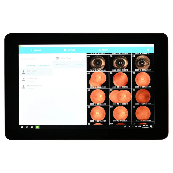 Automatic Non-Mydriatic Retinal Camera EFC-2600 – 12 MP
