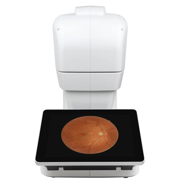 Automatic Non-Mydriatic Retinal Camera EFC-2600 – 12 MP