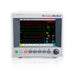 Embra VS50 Patient Monitor — ECG, SpO2, NIBP and Temperature